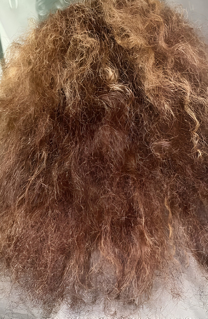 Antes